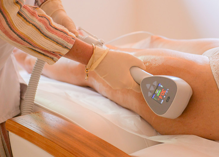 radiofréquence exilis 360